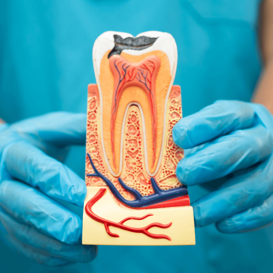 Root Canal Therapy for Throbbing Toothache
