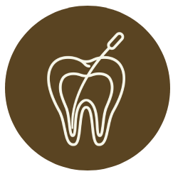 root canal therapy in Bangalore