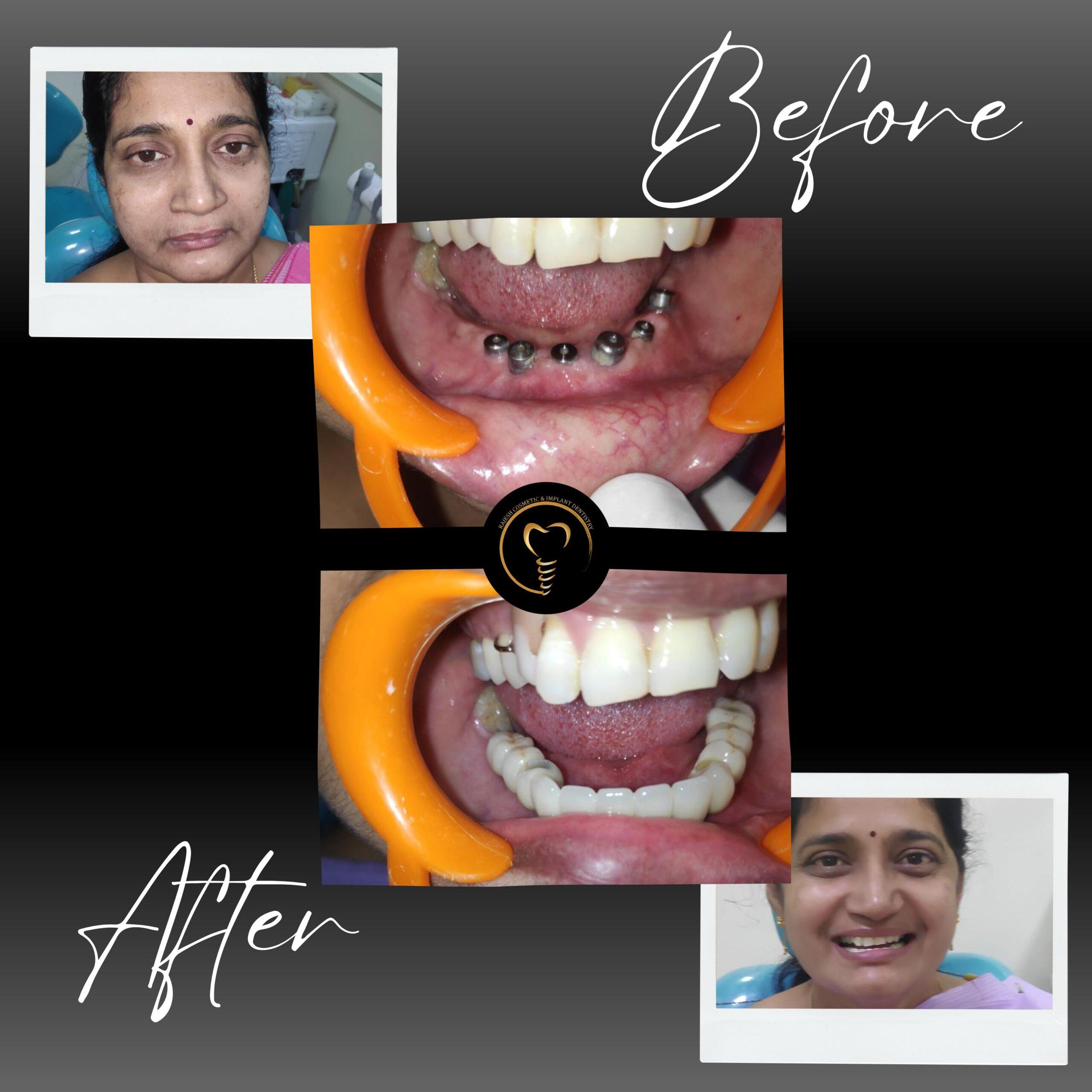 best dental services in bangalore