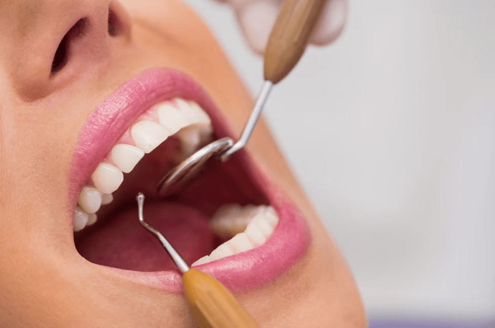 best dental implant in Bangalore